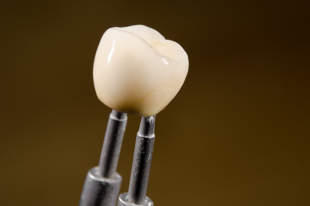close up picture of dental crown
