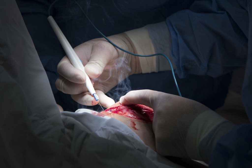 surgeon uses electrosurgery instrument