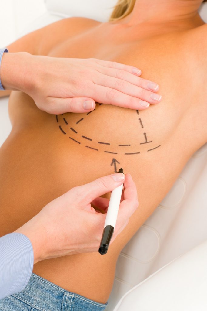 a surgeon drawing on the area of the skin