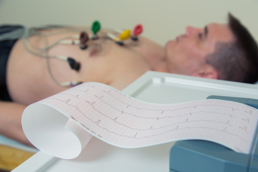man undergoing ECG while laying down on a bed