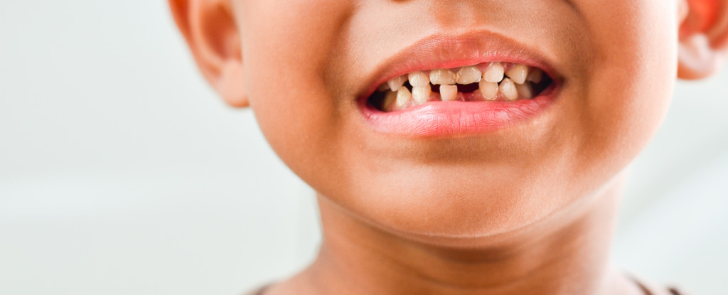 smiling kid with missing teeth