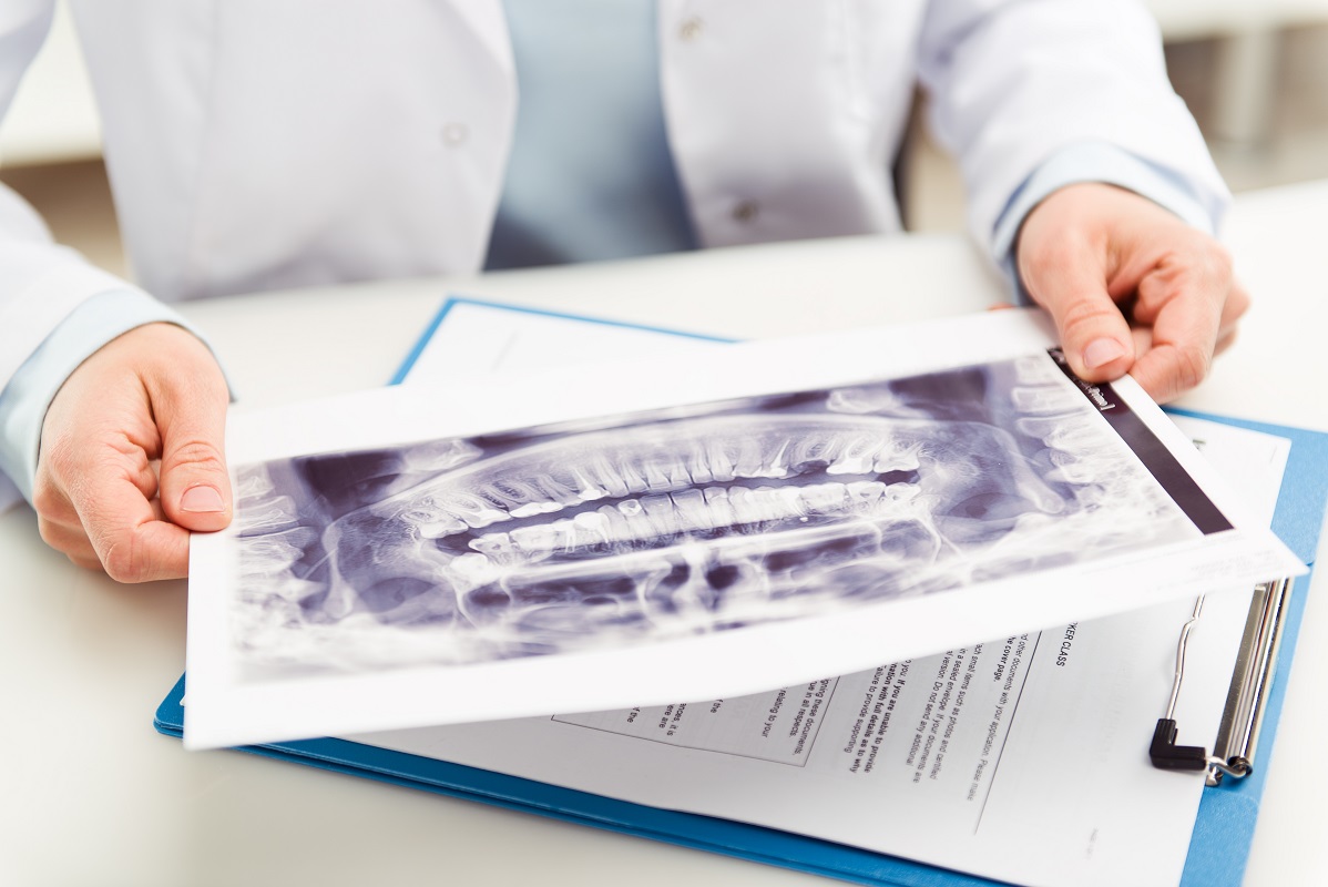 a dentist holding a teeth x-ray